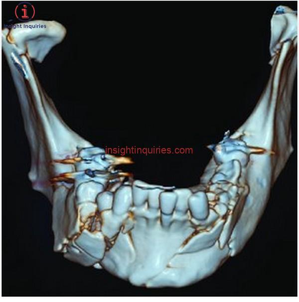 Fotos de Canserbero con la mandíbula rota: Controversia y detalles opacos de su muerte