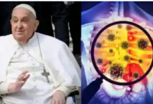 Pope Francis death cause