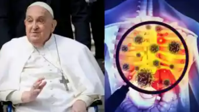 Pope Francis death cause